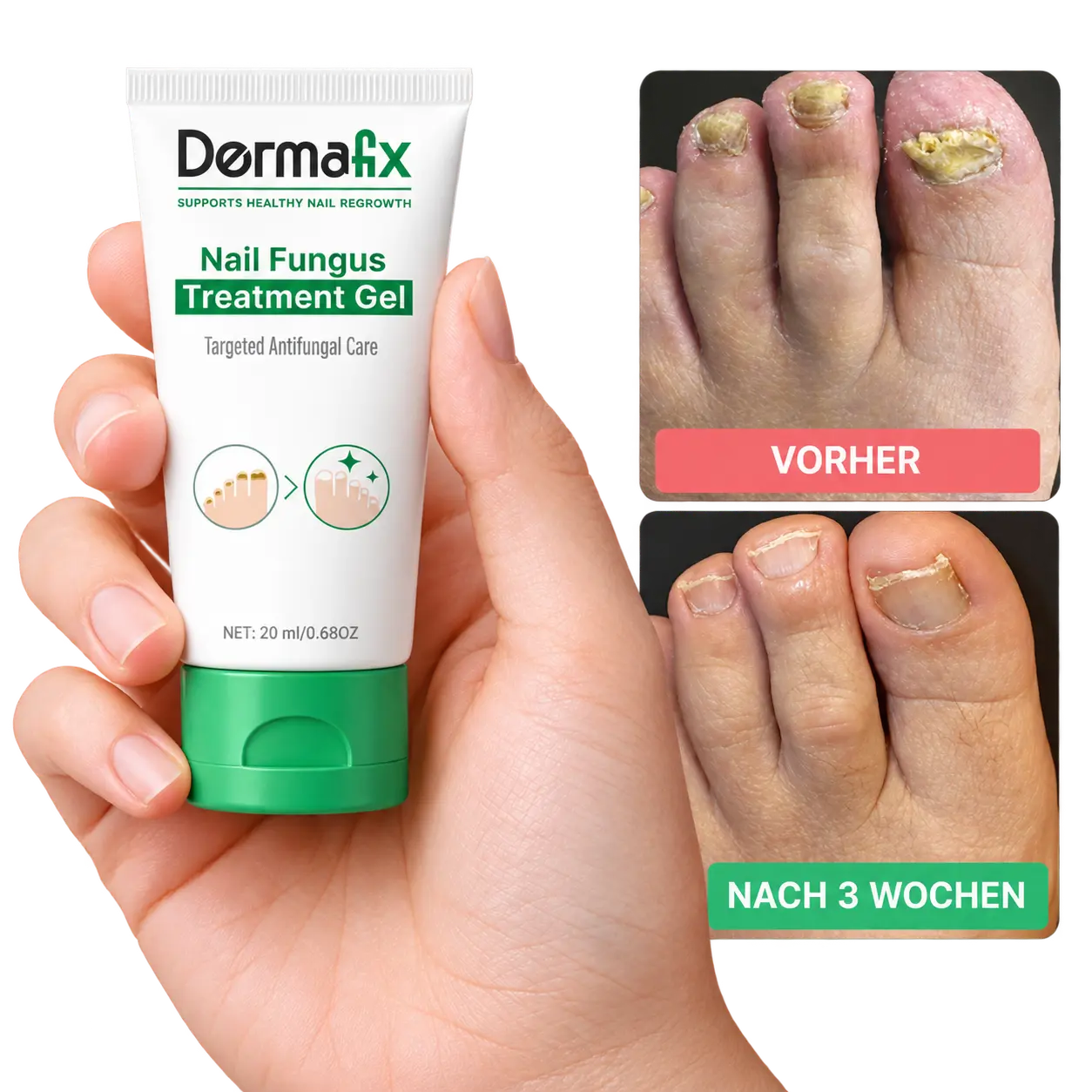 Dermafix Anti-Pilz-Gel mit Vorher-Nachher-Vergleich